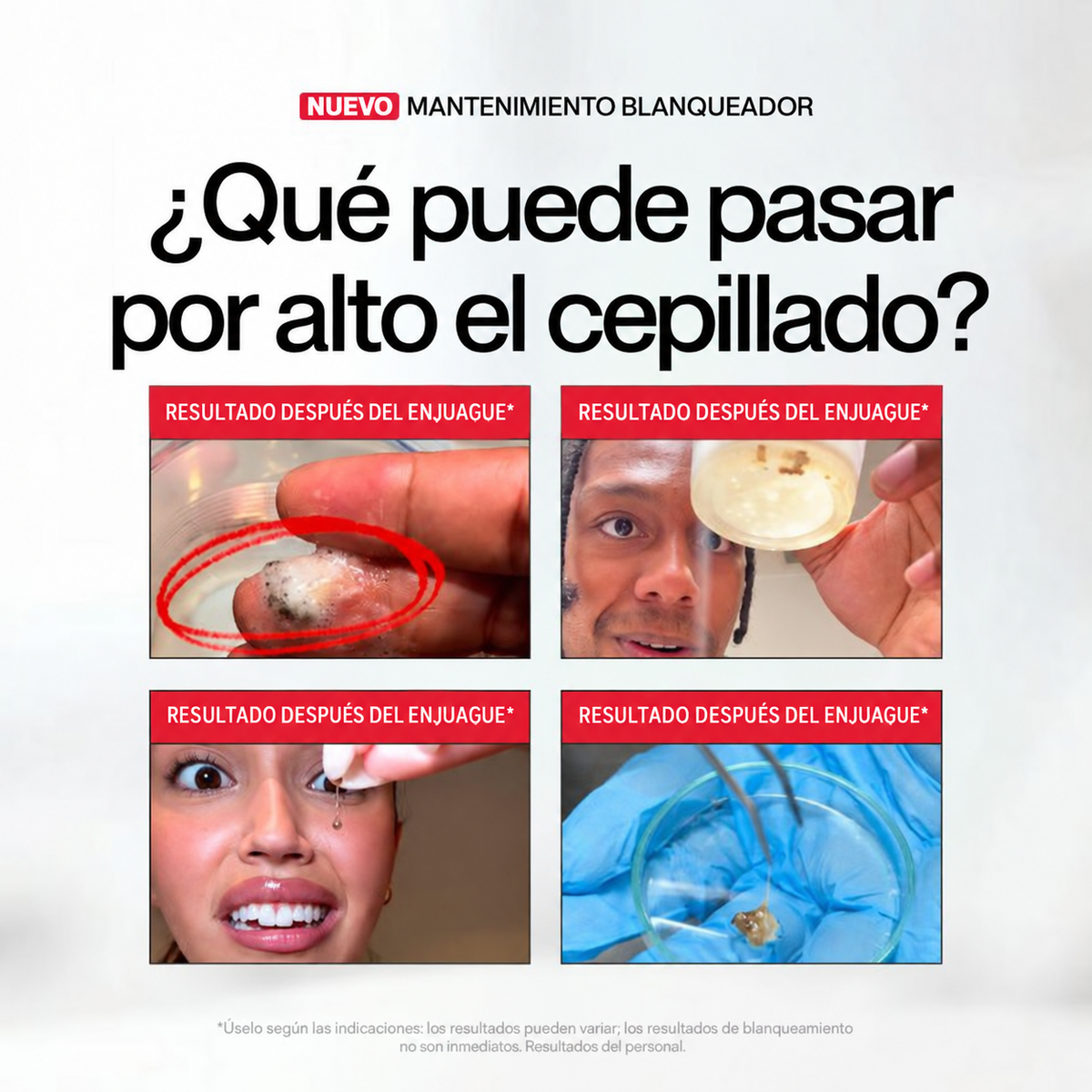 Enjuague bucal iD Stain - Salud oral