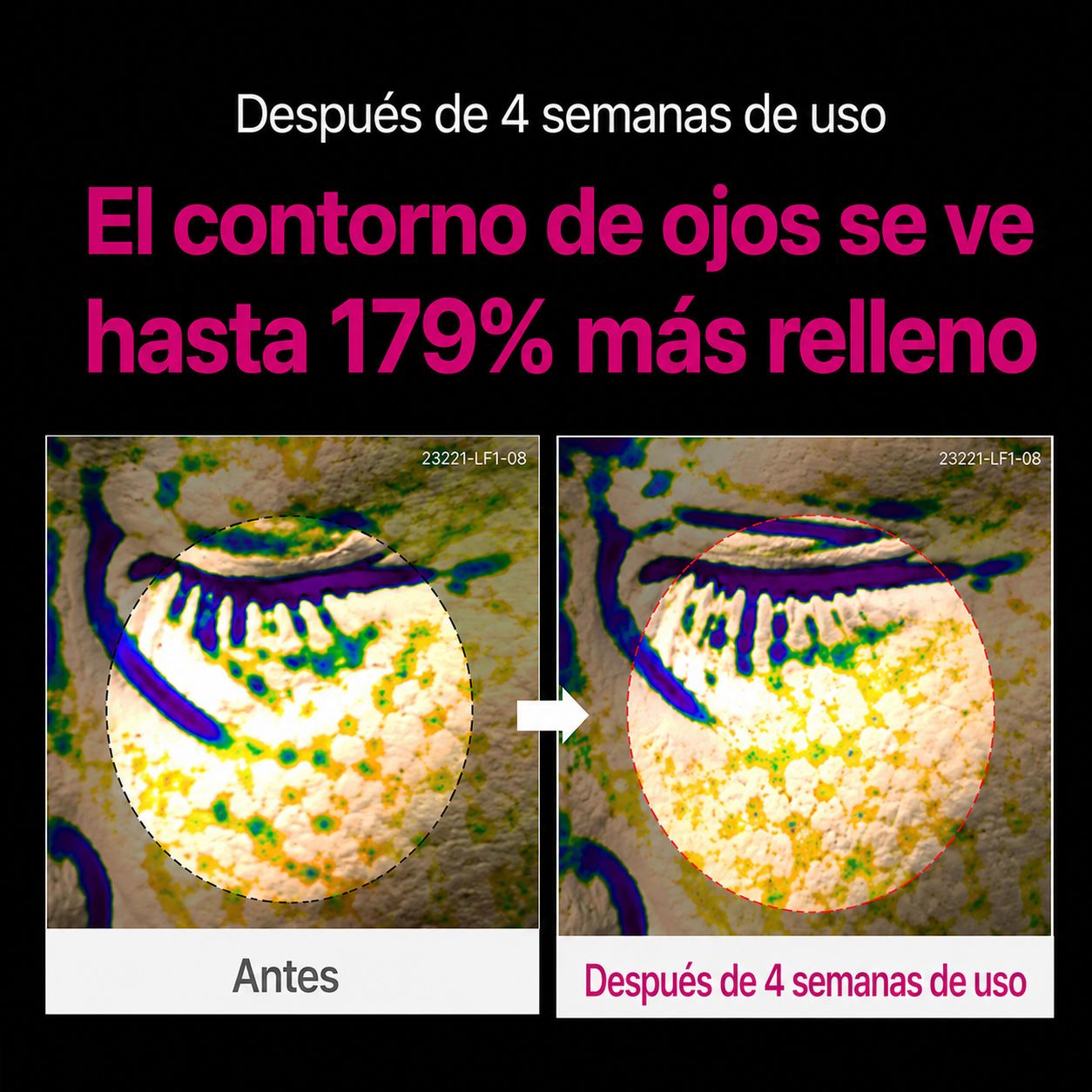 Tratamiento Coreano Contorno de Ojos