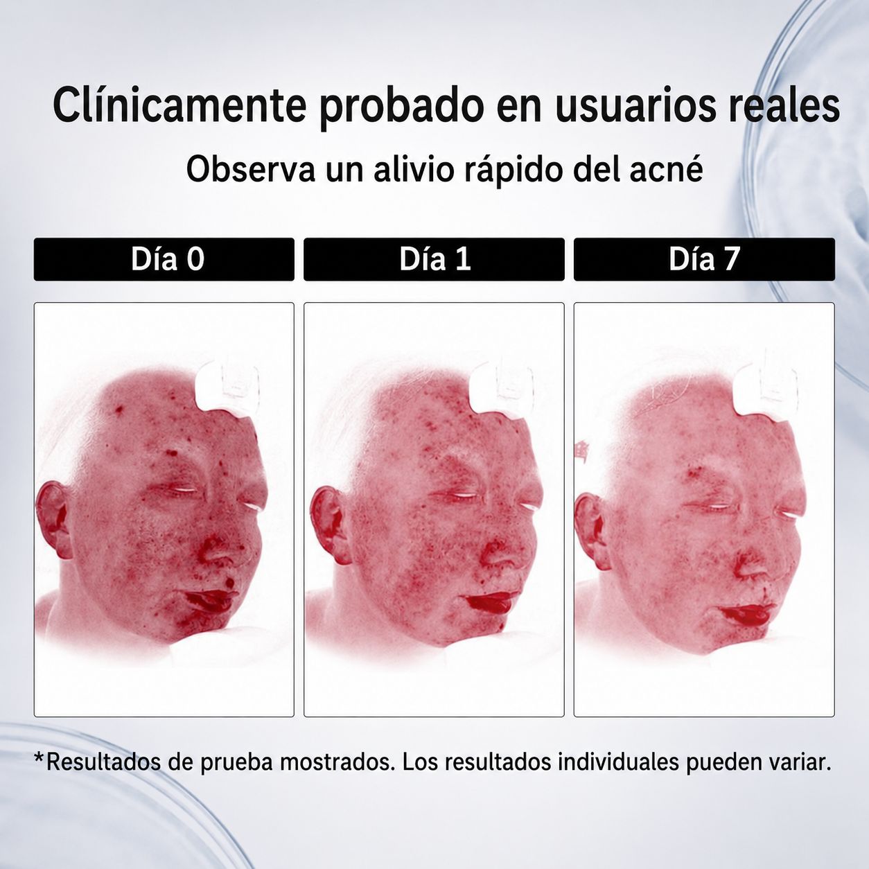 Dr. Leo | Loción Secante Anti-Imperfecciones