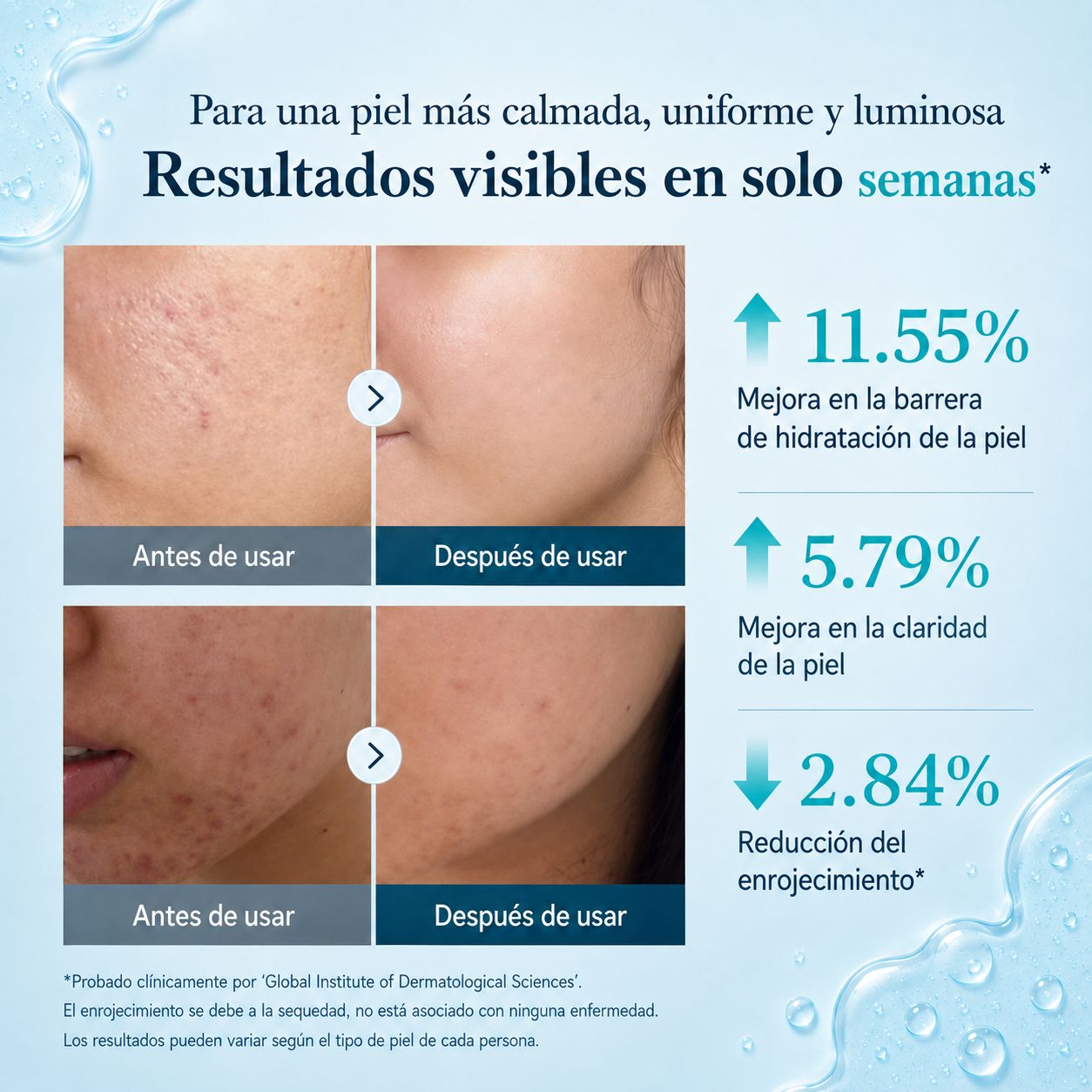 Sérum Coreano Ácido Azelaico 16%