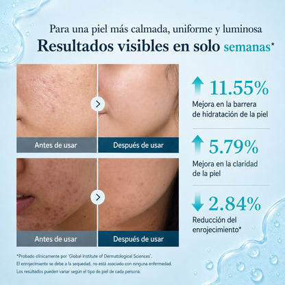 Sérum Coreano Ácido Azelaico 16%