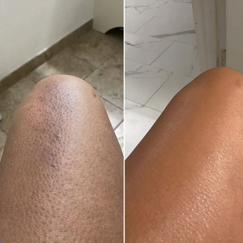 Peel Shot™ Exfoliante Corporal Kojic + Turmeric
