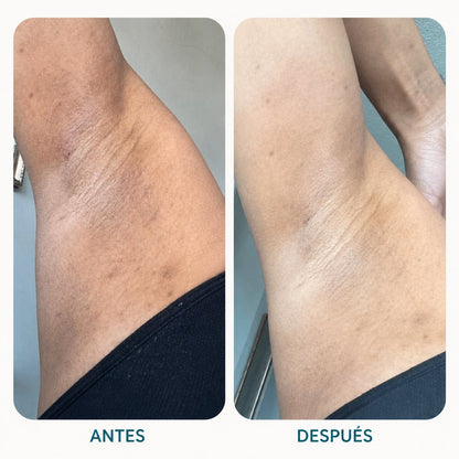 Almond Clear® Sérum Corporal