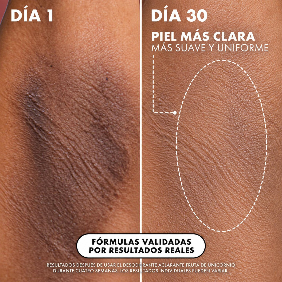 Desodorante Aclarador y Suavizante de Axilas